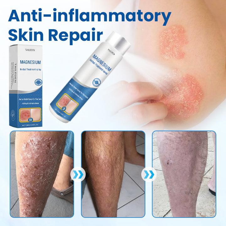 Eczema, Psoriasis & Skin Tags Gone Naturally with TAILEDEN®