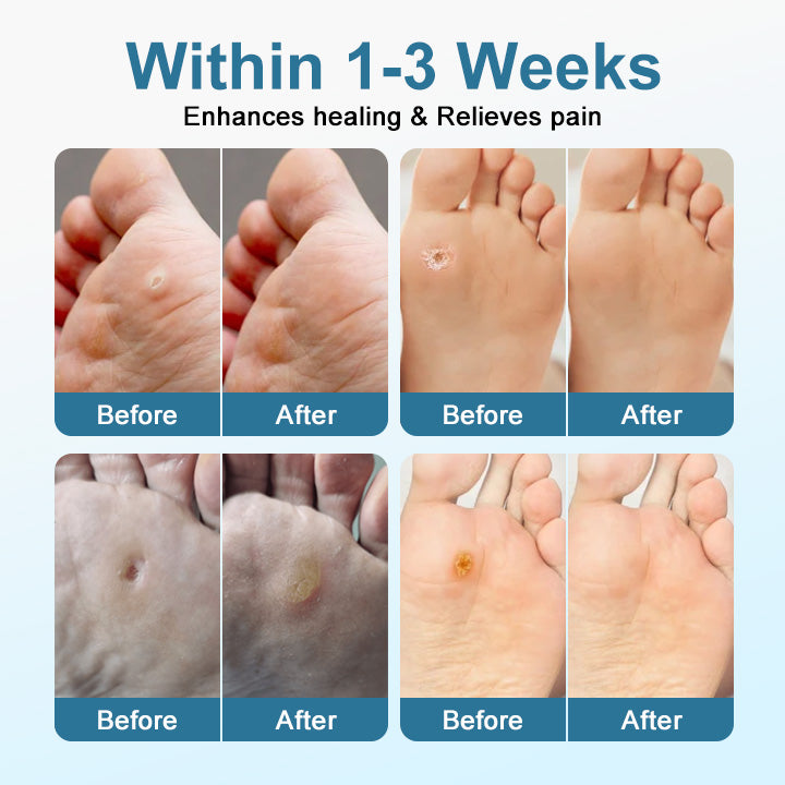 Advanced Diabetic Skin Care – Heal, Protect & Restore with TAILEDEN® VitaGluco