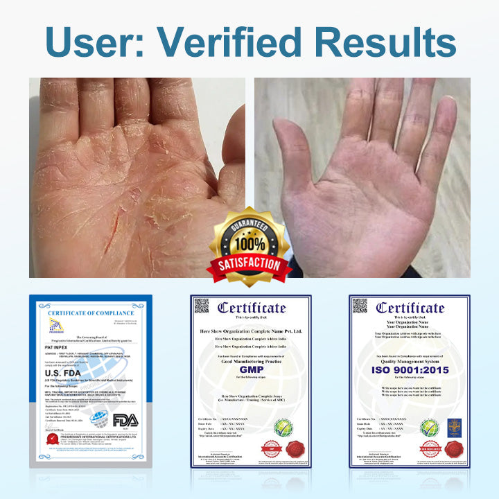 Advanced Diabetic Skin Care – Heal, Protect & Restore with TAILEDEN® VitaGluco