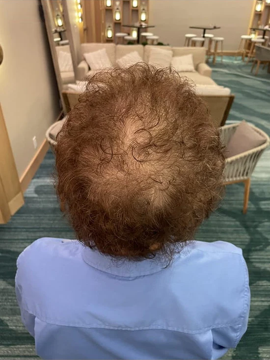 Customer hair result image two
